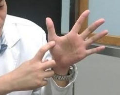 手指生锈了怎么除锈,手指感觉生锈了