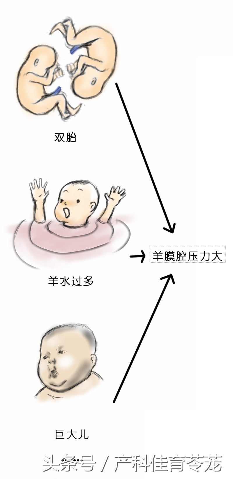 破水了,害怕吗?产科医生教您这样应对