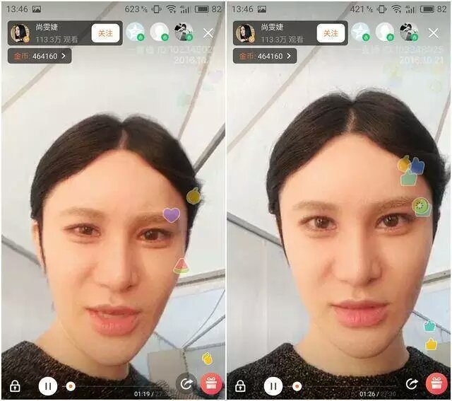 女明星整容后后遗症,女明星整容后出现后遗症