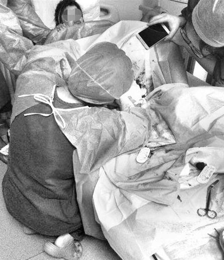 “邓超”曝光一助产士跪地40分钟，为患精神分裂产妇缝针