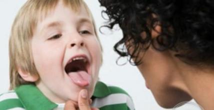 舌头下面系带处溃疡怎么治,舌头下面的系带有什么用