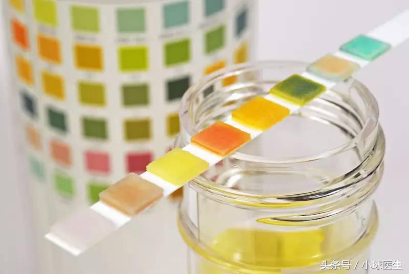 如何留取尿液标本，看了就知道！