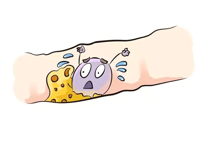 儿童耵聍要不要掏,宝宝耵聍要不要掏出来