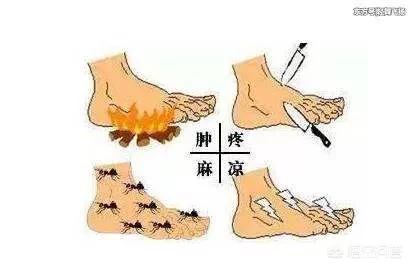 糖尿病足患者脚部症状提示,糖尿病并发症在脚部的症状有哪些