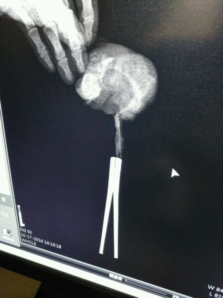 小仓鼠越狱了,仓鼠越狱的时候被压嘴巴歪了