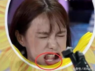 沈梦辰下巴真实照片,沈梦辰取鼻假体