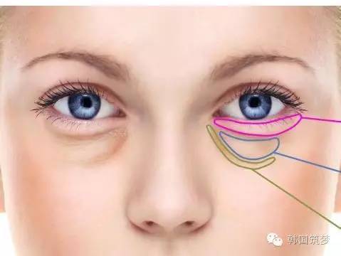 卧蚕与眼袋别傻傻分不清楚,男人眼袋与卧蚕的区别