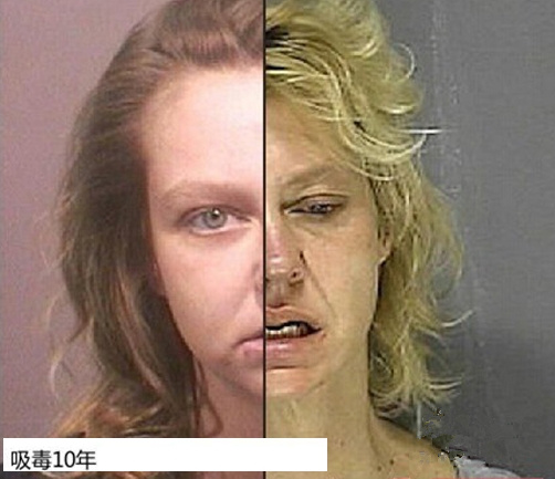 慎点！吸食*毒冰**后脸变形（组图）