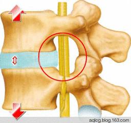 腰突的原因,腰突上午重下午轻的原因