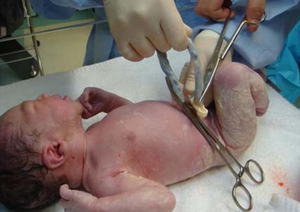 孕妇分娩骨缝开半指是不是快生了,孕妇骨缝开是什么感觉