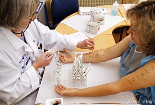 改善宝宝湿疹的物理方法,改善湿疹的图片