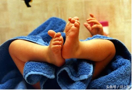 改善宝宝湿疹的物理方法,改善湿疹的图片