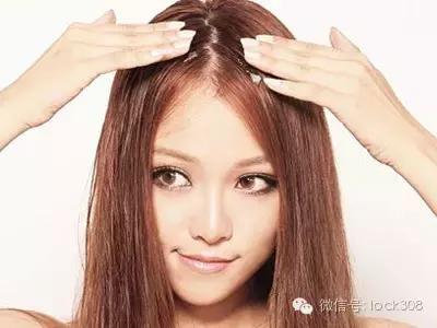 头顶稀疏发缝宽脂溢性脱发怎么办,前额头顶脱发稀疏细软怎样办