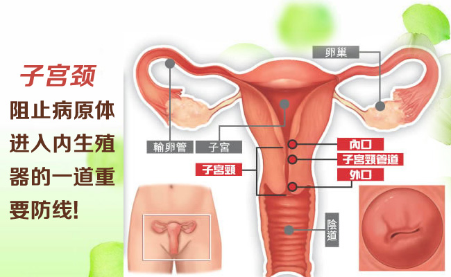 女性宫颈炎有哪些症状表现,女性得宫颈炎有什么表现