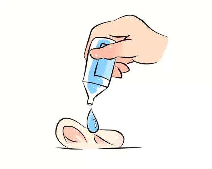 儿童耵聍要不要掏,宝宝耵聍要不要掏出来