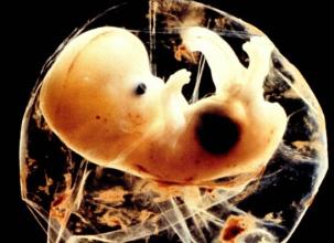 孕妇一天不喝水羊水会变少吗,一天不喝水羊水就少怎么回事