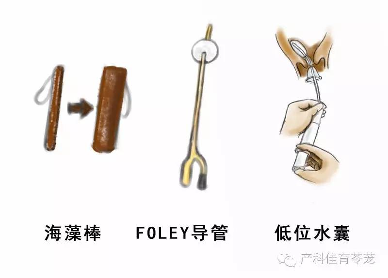 到日子了不生咋办？爬楼梯，吃辣椒...靠谱吗？