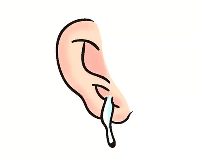 儿童耵聍要不要掏,宝宝耵聍要不要掏出来