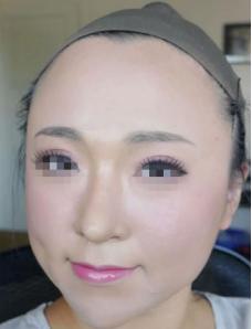 痱子粉也能隆鼻啊？看完给跪了