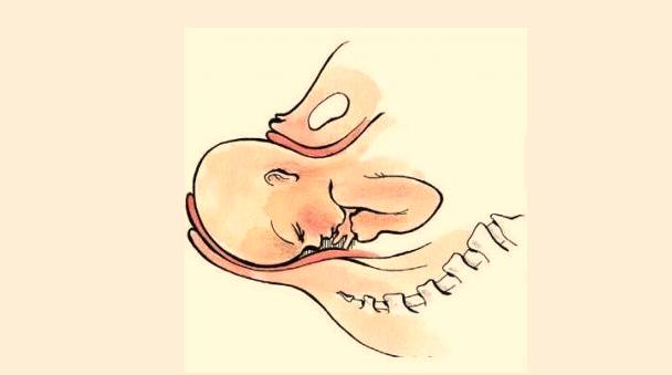 分娩如何克服恐惧感,分娩怎么办