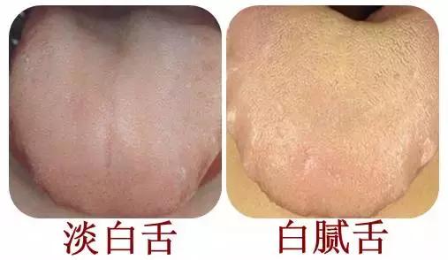 舌头不好,心脏不好会导致舌头有哪些症状