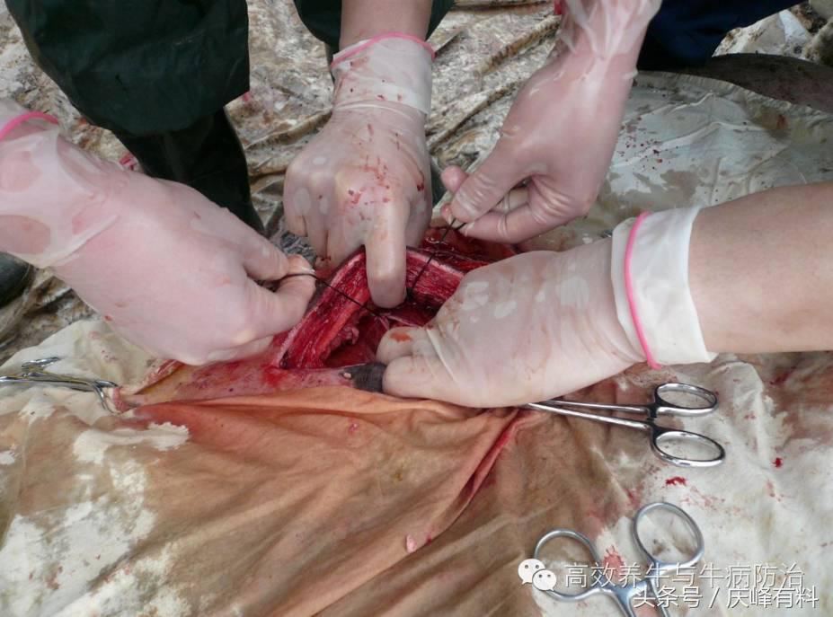奶牛真胃扩张的症状治疗方法,奶牛皱胃左方变位治疗方法