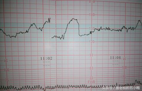 准妈妈必看的100个方法,b超单哪些数据可以判断要生了