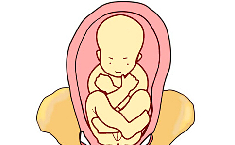 牛胎位不正怎样纠正,胎位不正臀位纠正操