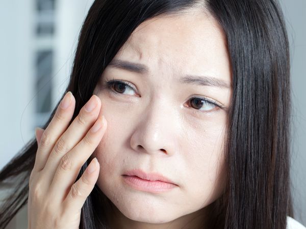 寒风一吹，为什么脸会突发红，还有刺痛感？