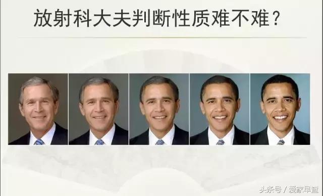 布什还是奥巴马?放射科杨大夫谈体检查出的结节和囊肿