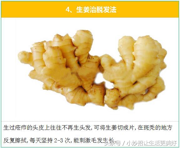 治疗脱发最快的方法小妙招,严重脱发治疗最有效的方法