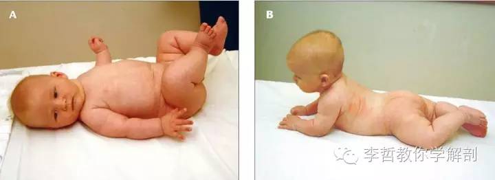 学员精彩笔记（2）|什么是后表线？它到底在人体中扮演怎样的角色