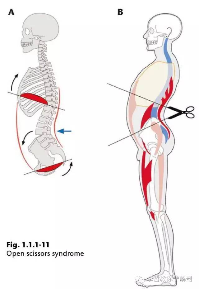学员精彩笔记（2）|什么是后表线？它到底在人体中扮演怎样的角色