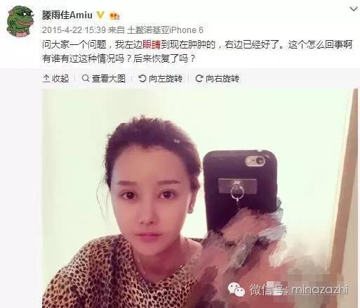 滕雨佳林珊珊谁混得好,滕雨佳林珊珊视频