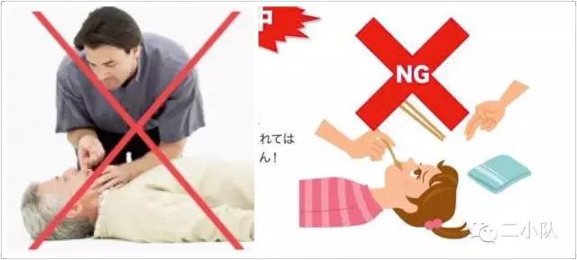 惊厥癫痫怎么才能控制发作,癫痫病发作时的惊厥怎么办