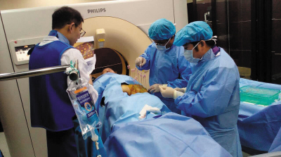 3d打印手术成功案例,3d打印技术器官移植