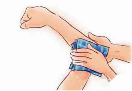 外伤急救的注意事项,急救知识伤口少量出血怎么处理