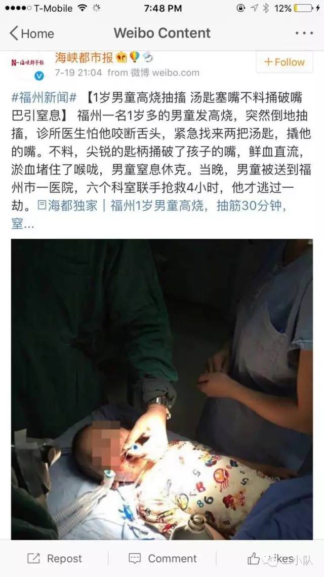 惊厥癫痫怎么才能控制发作,癫痫病发作时的惊厥怎么办