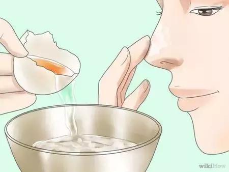 去草莓鼻最有效的产品,草莓鼻的有效解决方法