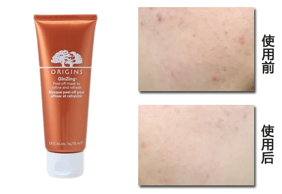 悦木之源夜间修复面膜,悦木之源活性炭毛孔净透面膜测评