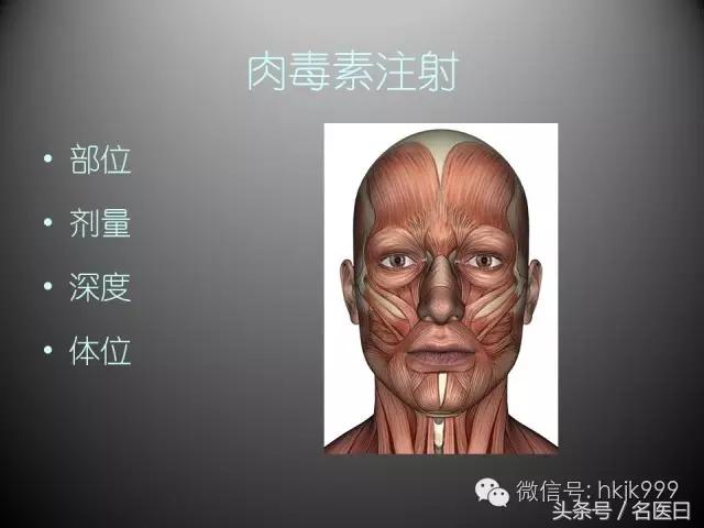 注射肉毒素也存在风险,例如注射完不会笑了,肌肉不会动了