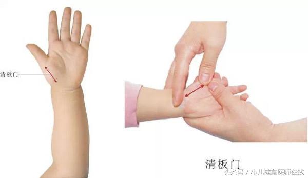 水痘的小儿推拿手法,吴老师推拿视频