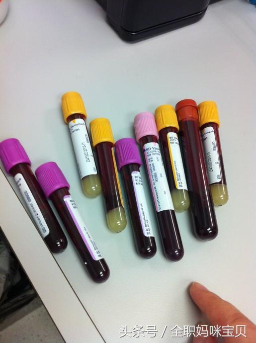 孕妇糖筛检查不过怎么办,糖筛孕妇晕了