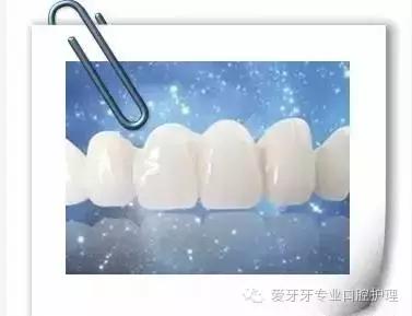 不同价格的牙冠区别在哪里,不同价格的烤瓷有区别吗