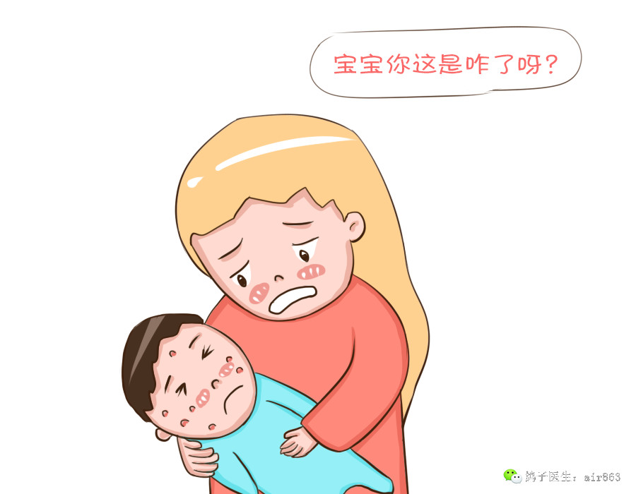 宝宝出水痘？不用怕，妈妈可以这样做！