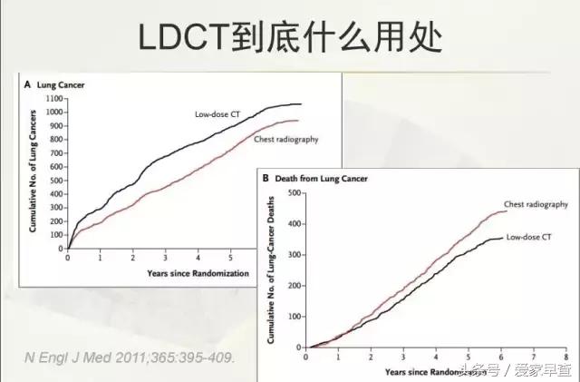 布什还是奥巴马?放射科杨大夫谈体检查出的结节和囊肿