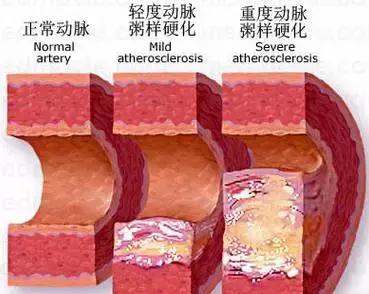 盐的巧妙利用,盐的小妙招大全