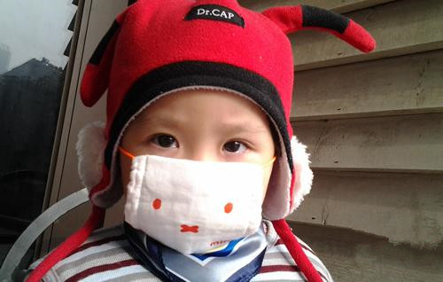 冬天宝宝脸皴了不愿擦霜,冬天宝宝脸皴了擦甘油可以吗