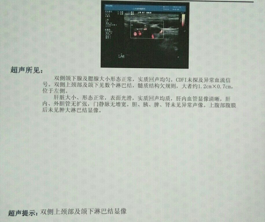 治疗舌癌能治好吗需要多少钱,治疗舌癌去肿瘤科还是咽喉科