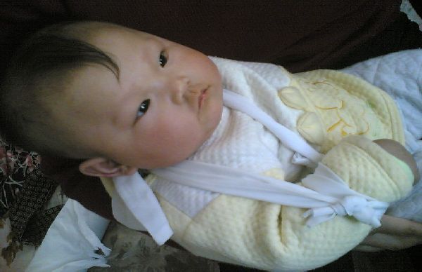 一岁半的宝宝肘关节脱位了怎么办,宝宝肘关节半脱位会影响今后吗